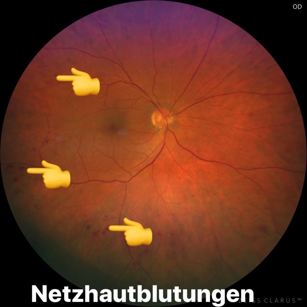 Diagnostische Netzhaut-Untersuchung